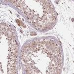 POLR3F Polyclonal Antibody