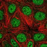 WDR18 Polyclonal Antibody