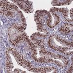 WDR18 Antibody in Immunohistochemistry (Paraffin) (IHC (P))