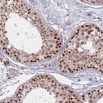 WDR18 Antibody in Immunohistochemistry (Paraffin) (IHC (P))