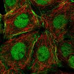 NCOA5 Polyclonal Antibody