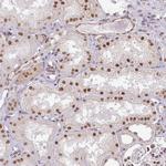 NCOA5 Antibody in Immunohistochemistry (Paraffin) (IHC (P))