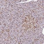 NCOA5 Antibody in Immunohistochemistry (Paraffin) (IHC (P))