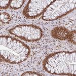 NCOA5 Antibody in Immunohistochemistry (Paraffin) (IHC (P))