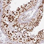 NCOA5 Antibody in Immunohistochemistry (Paraffin) (IHC (P))