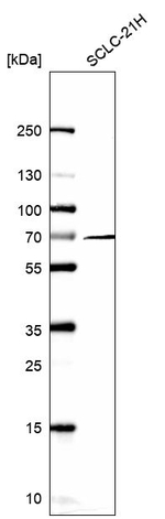 NCOA5 Antibody in Western Blot (WB)