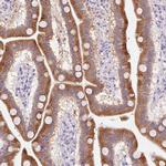 HSD17B2 Antibody in Immunohistochemistry (IHC)