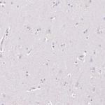 HSD17B2 Antibody in Immunohistochemistry (IHC)