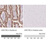 HSD17B2 Antibody