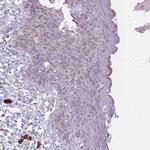 DCHS1 Antibody in Immunohistochemistry (Paraffin) (IHC (P))