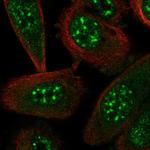 STYXL1 Polyclonal Antibody