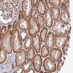 STYXL1 Antibody in Immunohistochemistry (Paraffin) (IHC (P))