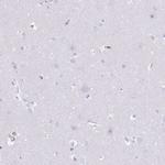 HRG Antibody in Immunohistochemistry (Paraffin) (IHC (P))