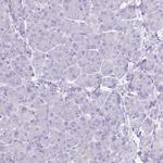 HRG Polyclonal Antibody