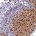 C19orf25 Polyclonal Antibody