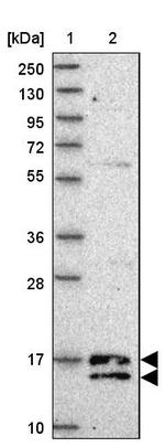 C19orf25 Antibody in Western Blot (WB)