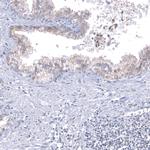 TMED5 Antibody in Immunohistochemistry (Paraffin) (IHC (P))