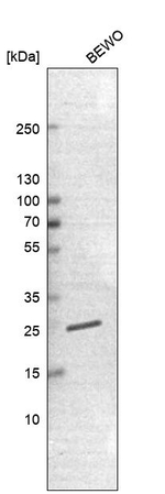 TMED5 Antibody in Western Blot (WB)