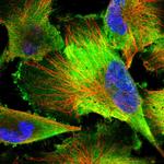 PDAP1 Polyclonal Antibody