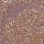PDAP1 Antibody in Immunohistochemistry (Paraffin) (IHC (P))
