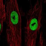 LRRN4CL Polyclonal Antibody