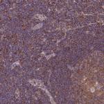 LRRN4CL Antibody in Immunohistochemistry (Paraffin) (IHC (P))