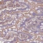 LRRN4CL Antibody in Immunohistochemistry (Paraffin) (IHC (P))
