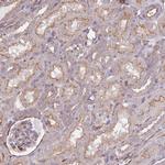 LRRN4CL Antibody in Immunohistochemistry (IHC)