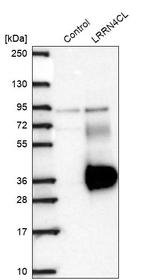 LRRN4CL Antibody in Western Blot (WB)