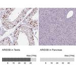 BDP Antibody in Immunohistochemistry (IHC)