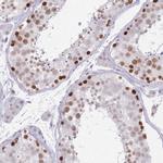 BDP Antibody in Immunohistochemistry (IHC)