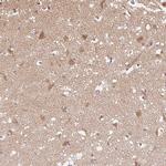 PPP4R4 Polyclonal Antibody