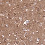 PPFIA3 Polyclonal Antibody