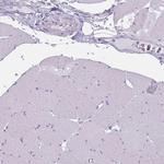 PPFIA3 Antibody in Immunohistochemistry (IHC)