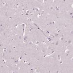 ELSPBP1 Antibody in Immunohistochemistry (Paraffin) (IHC (P))