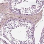 ELSPBP1 Antibody in Immunohistochemistry (Paraffin) (IHC (P))