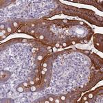 HOOK2 Polyclonal Antibody