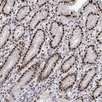 XPG Antibody in Immunohistochemistry (Paraffin) (IHC (P))