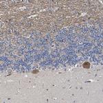 MDGA1 Polyclonal Antibody