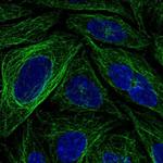 FBXL20 Polyclonal Antibody