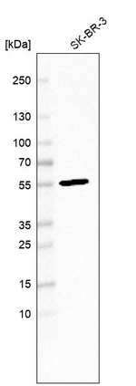 FBXL20 Antibody in Western Blot (WB)