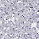 NHP2 Antibody in Immunohistochemistry (IHC)