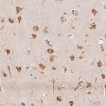 RCN3 Antibody in Immunohistochemistry (Paraffin) (IHC (P))
