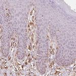 RCN3 Antibody in Immunohistochemistry (Paraffin) (IHC (P))