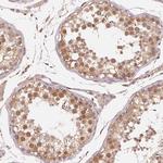 RCN3 Antibody in Immunohistochemistry (Paraffin) (IHC (P))