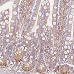 RCN3 Antibody in Immunohistochemistry (Paraffin) (IHC (P))