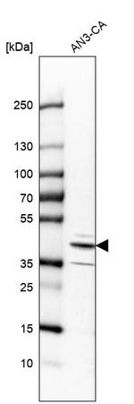 RCN3 Antibody in Western Blot (WB)