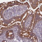 MRPS18C Antibody in Immunohistochemistry (Paraffin) (IHC (P))