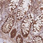 MRPL23 Antibody in Immunohistochemistry (Paraffin) (IHC (P))