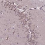 PNPLA5 Polyclonal Antibody